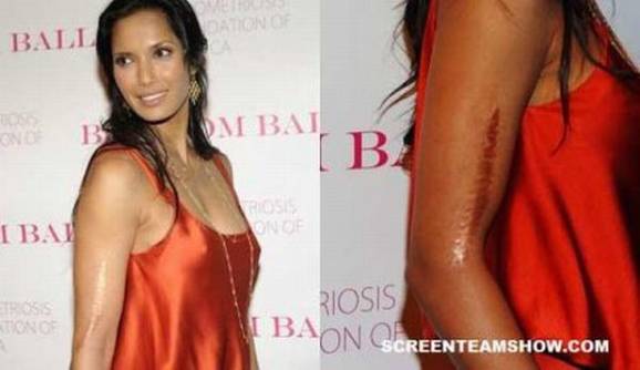 zvijezde s tjelesnim manama, Padma Lakshmi