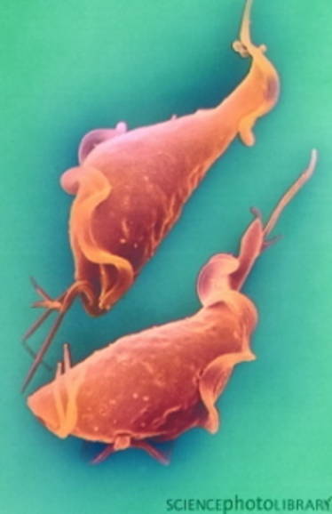 Trichomonas vaginalis je mikroogranizam koji uzrokuje trihomonijazu